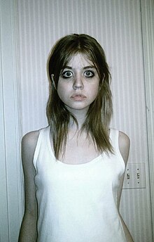 Allison Harvard