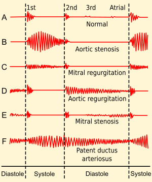 Heartbeat