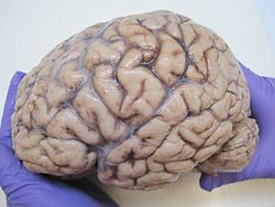 Human Brain