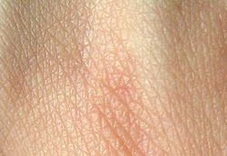 Human Skin