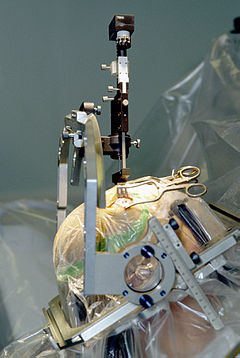 Neurosurgery